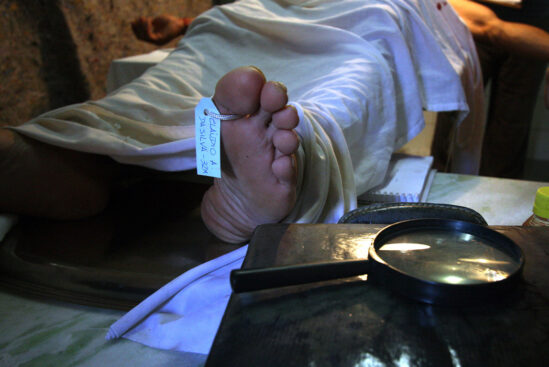 BIPOLAR – Episódio 04