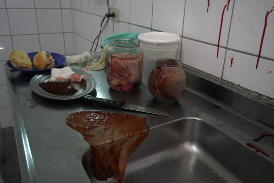 BIPOLAR – Episódio 10